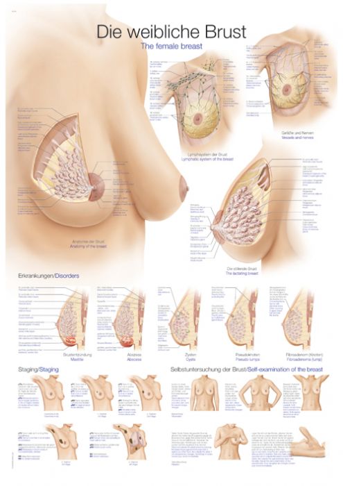 Poster Female Breast Different Types Sizes: stockvector (rechtenvrij)  1201290661